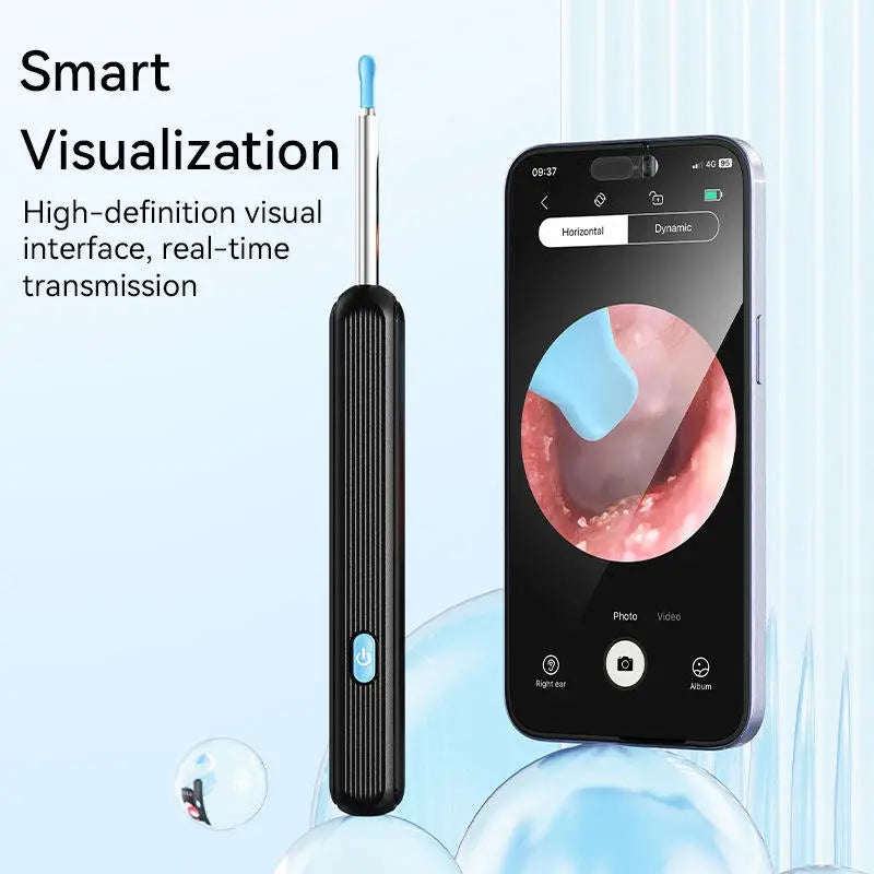 Smart Visual Ear Cleaner with HD Camera | WiFi Ear Wax Removal Tool | USB Type-C Rechargeable Otoscope | Compatible with Android & iOS